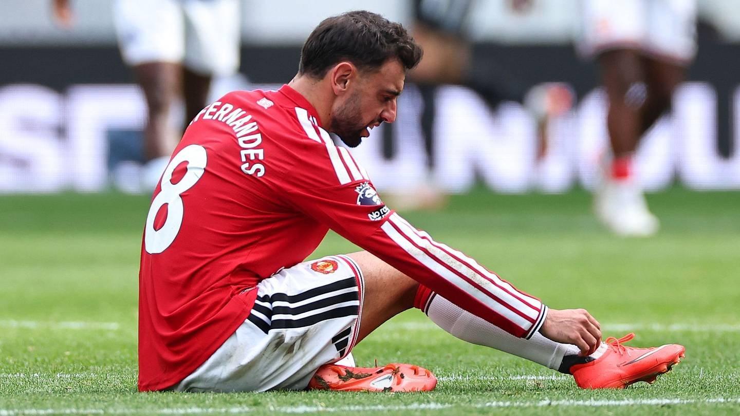 Bruno Fernandes chấn thương phức tạp sau trận Champions League